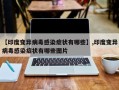 【印度变异病毒感染症状有哪些】,印度变异病毒感染症状有哪些图片